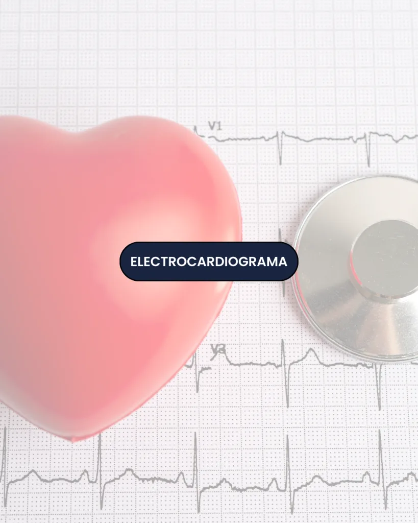 Electrocardiograma